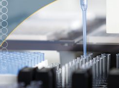 Laboratorio 4.0: Cómo mejorar el diagnóstico gracias a la automatización