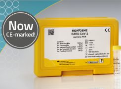 Coronavirus test kit receives CE label