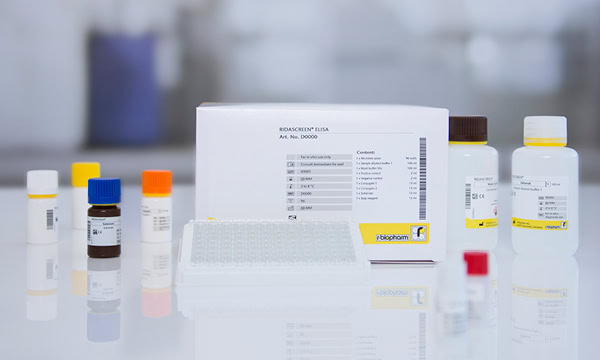 2026-04_challanges-in-gi-diagnostics_bilder-600-x-360-px_ridascreen