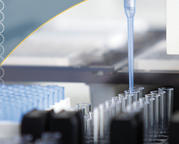 Laboratorio 4.0: Cómo mejorar el diagnóstico gracias a la automatización